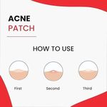 Eelhoe Hydrocolloid Acne Patches: Your Trusted Solution For Fast Acne Healing And Spot-Free Skin – 144 Patches (EELHOE)